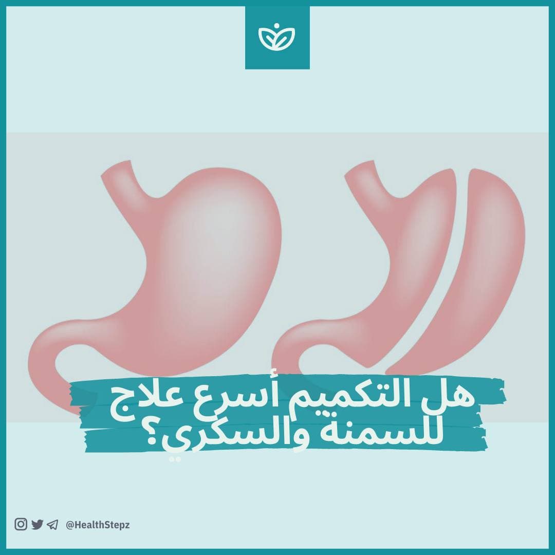 ✂️ هل التكميم أسرع علاج للسمنة والسكري؟