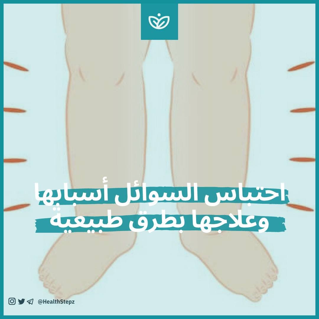 💧احتباس السوائل أسبابها وعلاجها بطرق طبيعية
