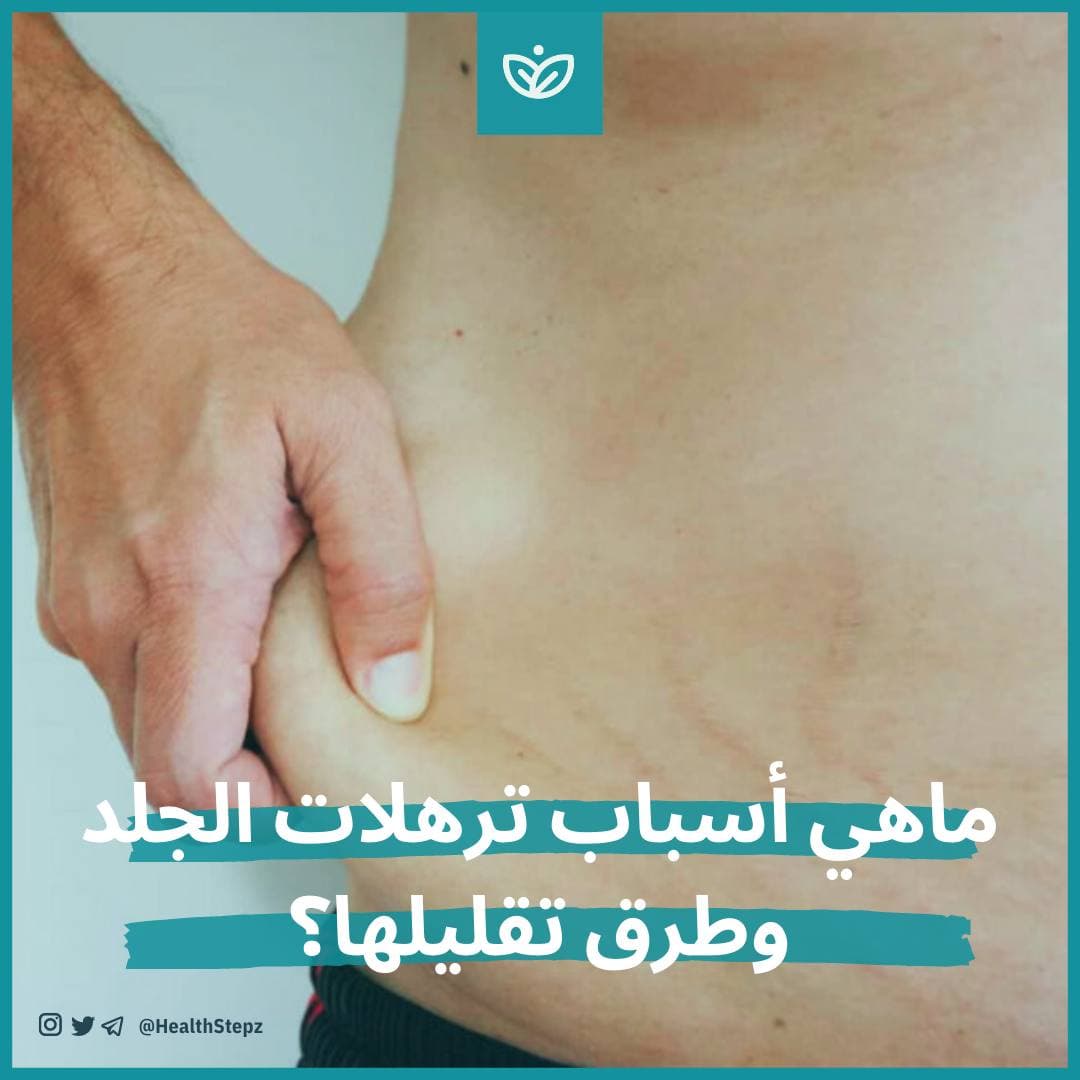 ? ماهي أسباب ترهلات الجلد وطرق تقليلها؟