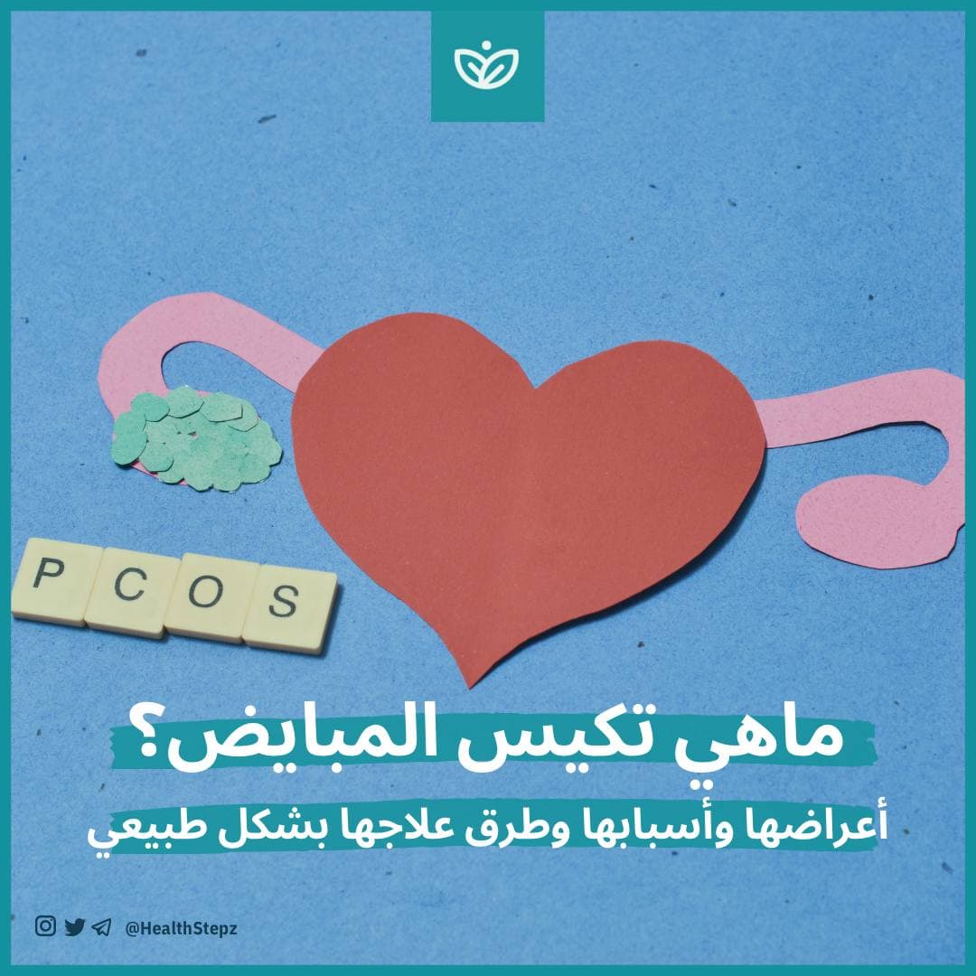 ? ماهي تكيس المبايض؟ أعراضها وأسبابها وطرق علاجها بشكل طبيعي