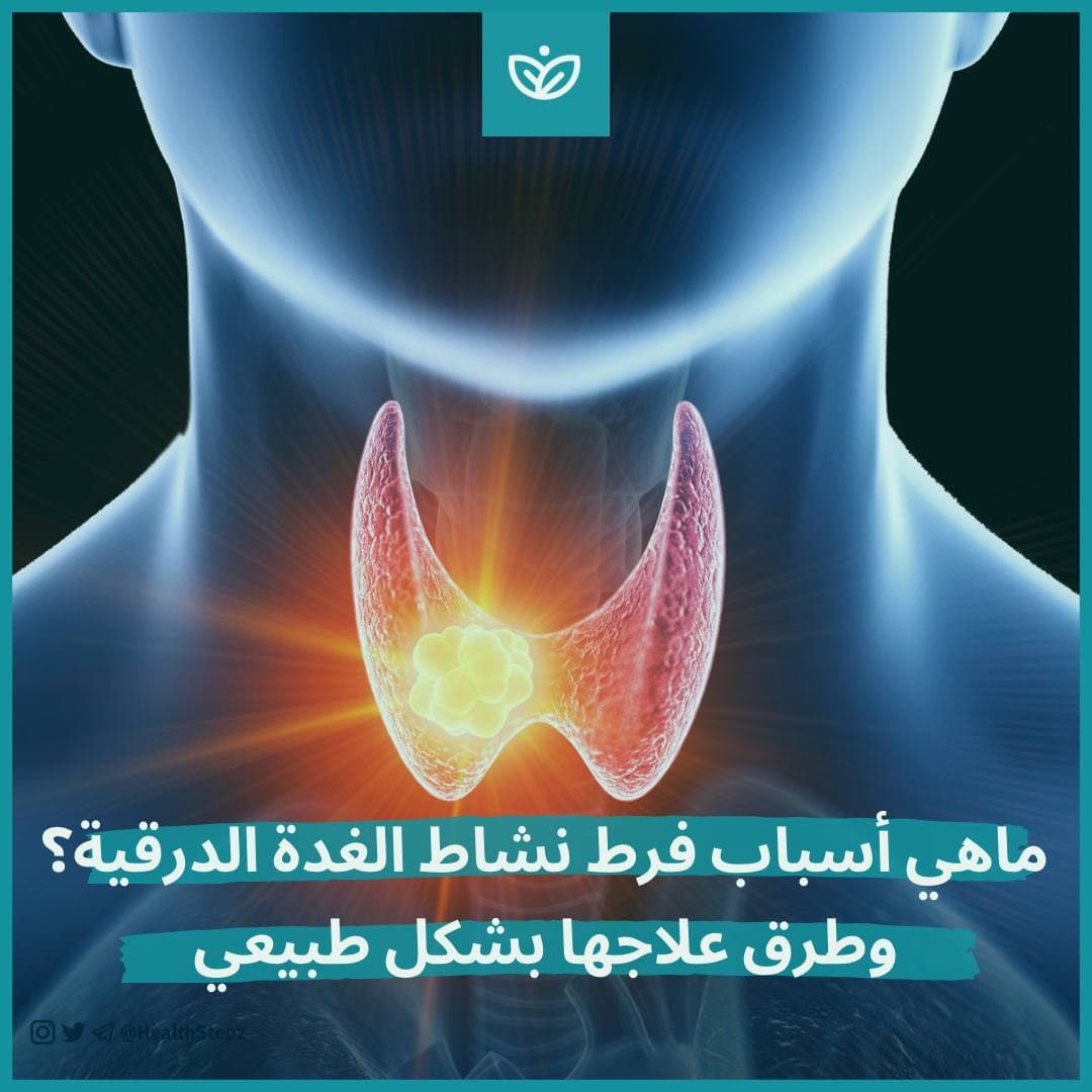 ?ماهي أسباب فرط نشاط الغدة الدرقية؟ وطرق علاجها بشكل طبيعي