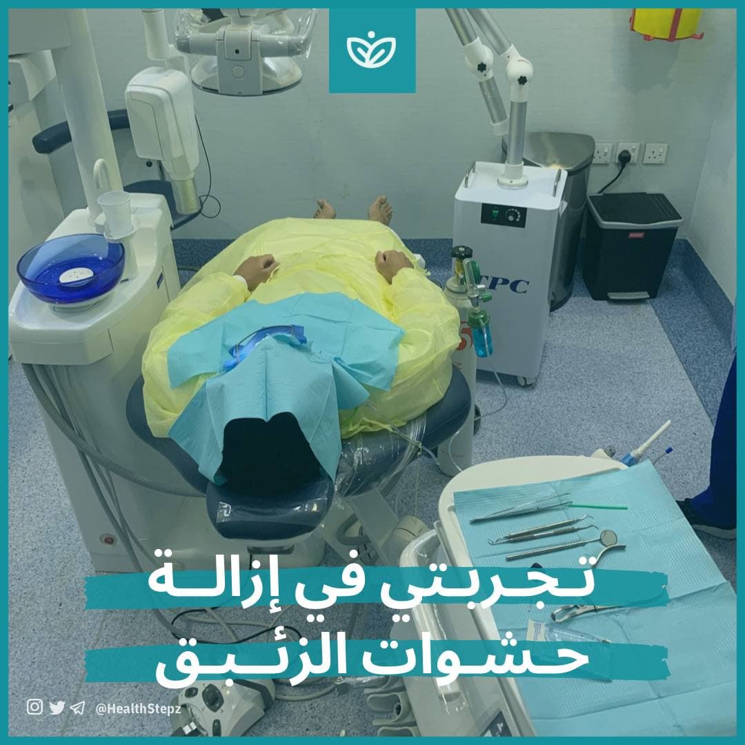 تجربتي في إزالة حشوات الزئبق